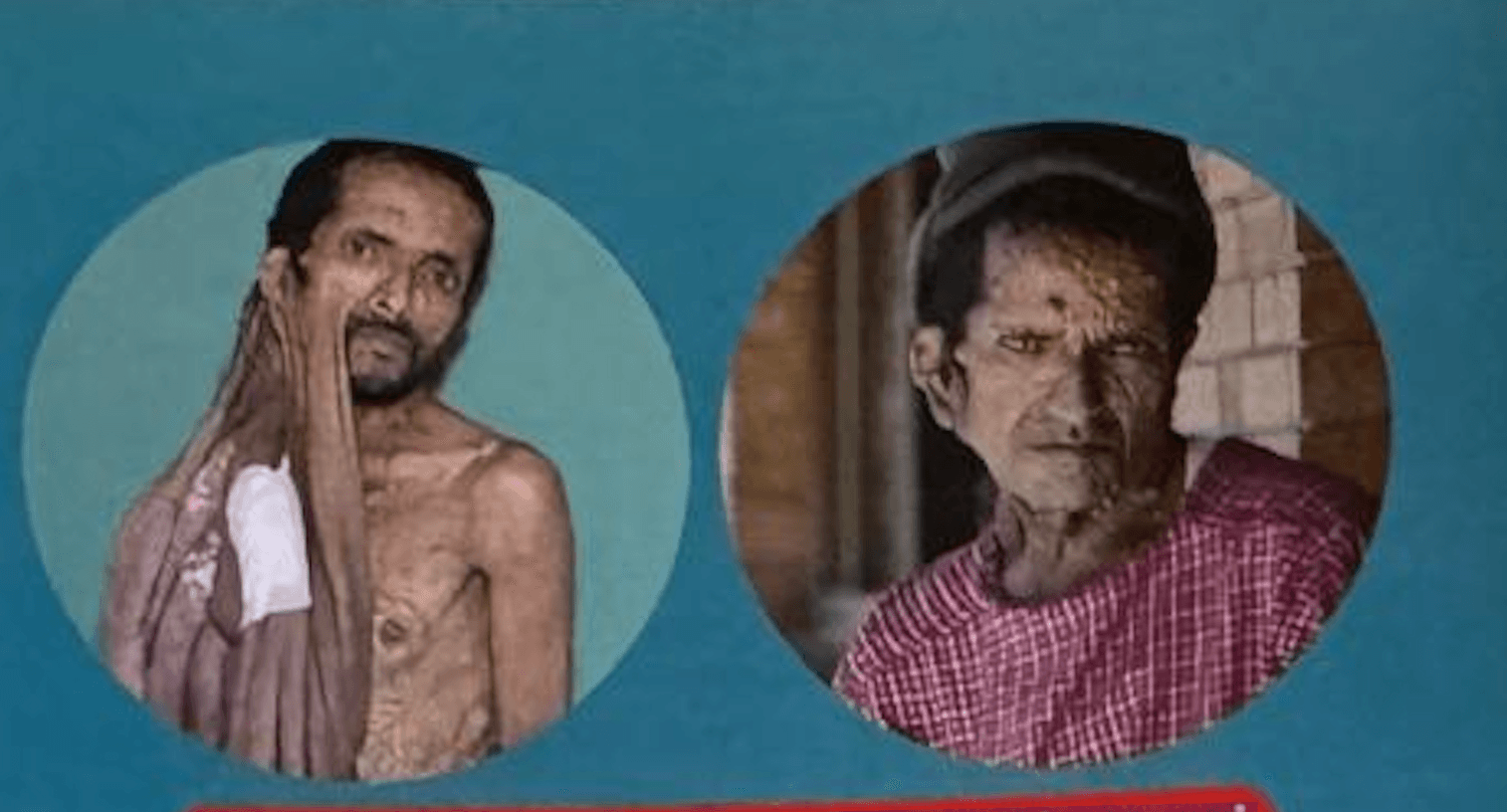 A New Life for Mr. Krishna Prasad Bhattarai