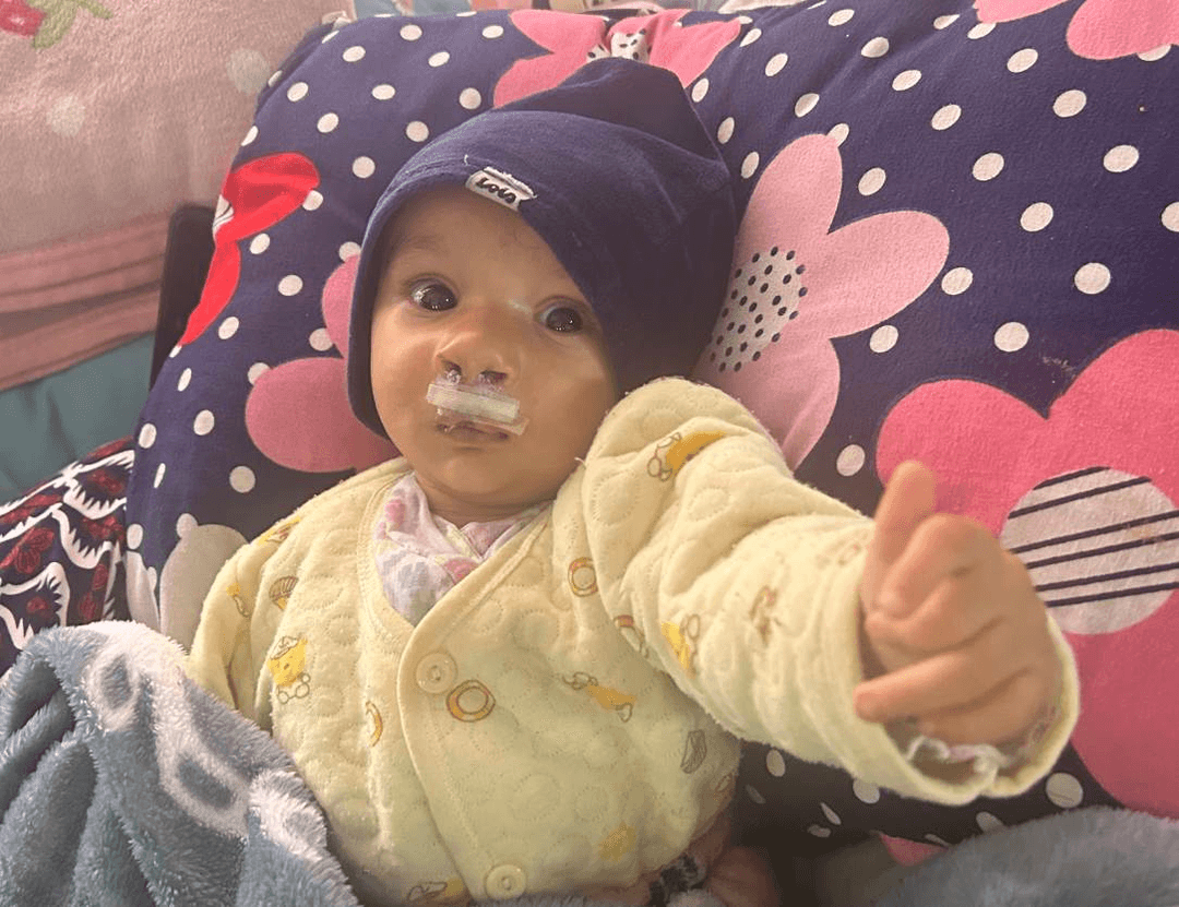 A New Smile for Pragyan: Changing a Life Before the First Birthday