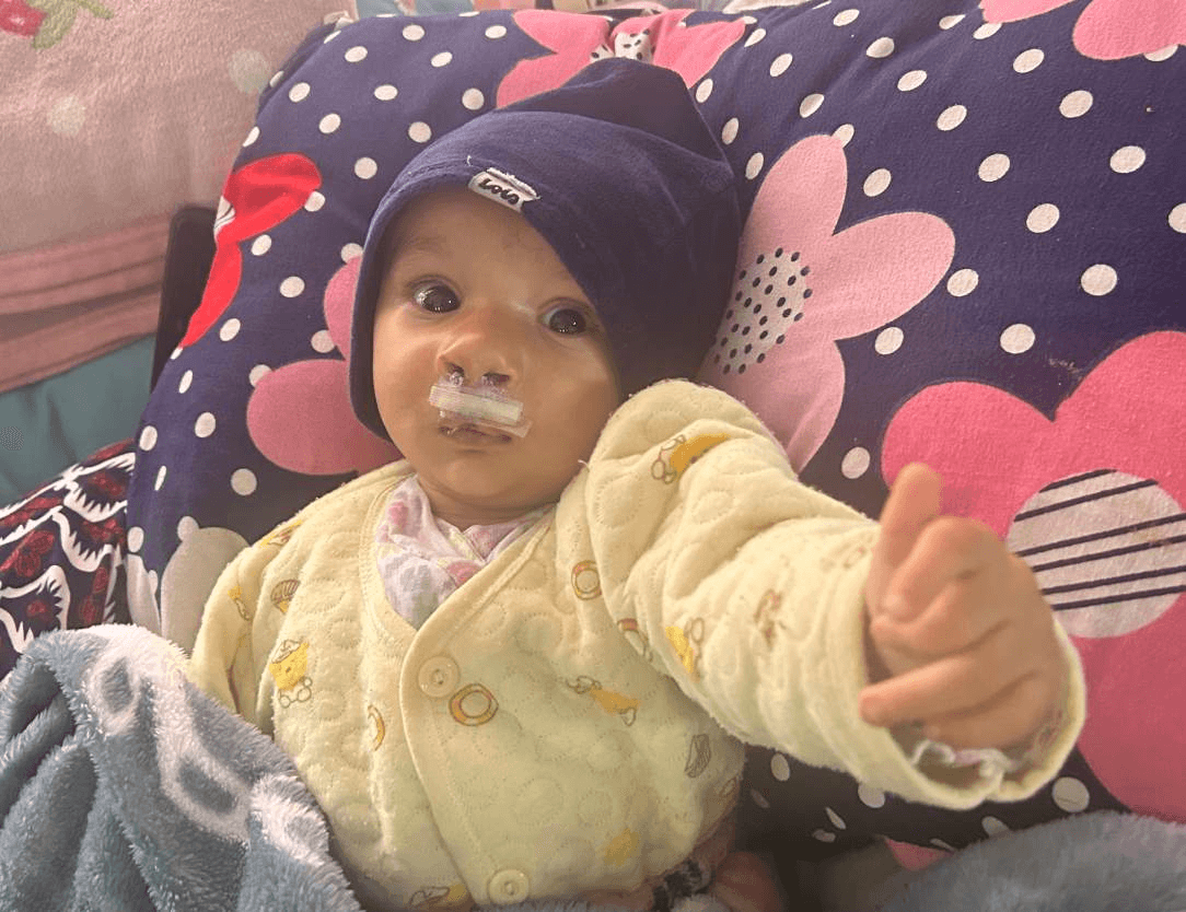 A New Smile for Pragyan: Changing a Life Before the First Birthday