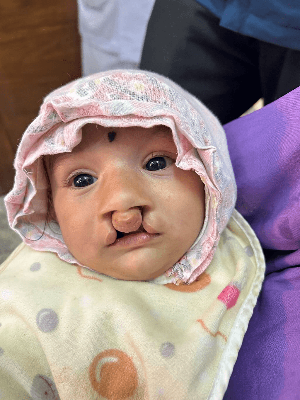 Pragyan before surgery