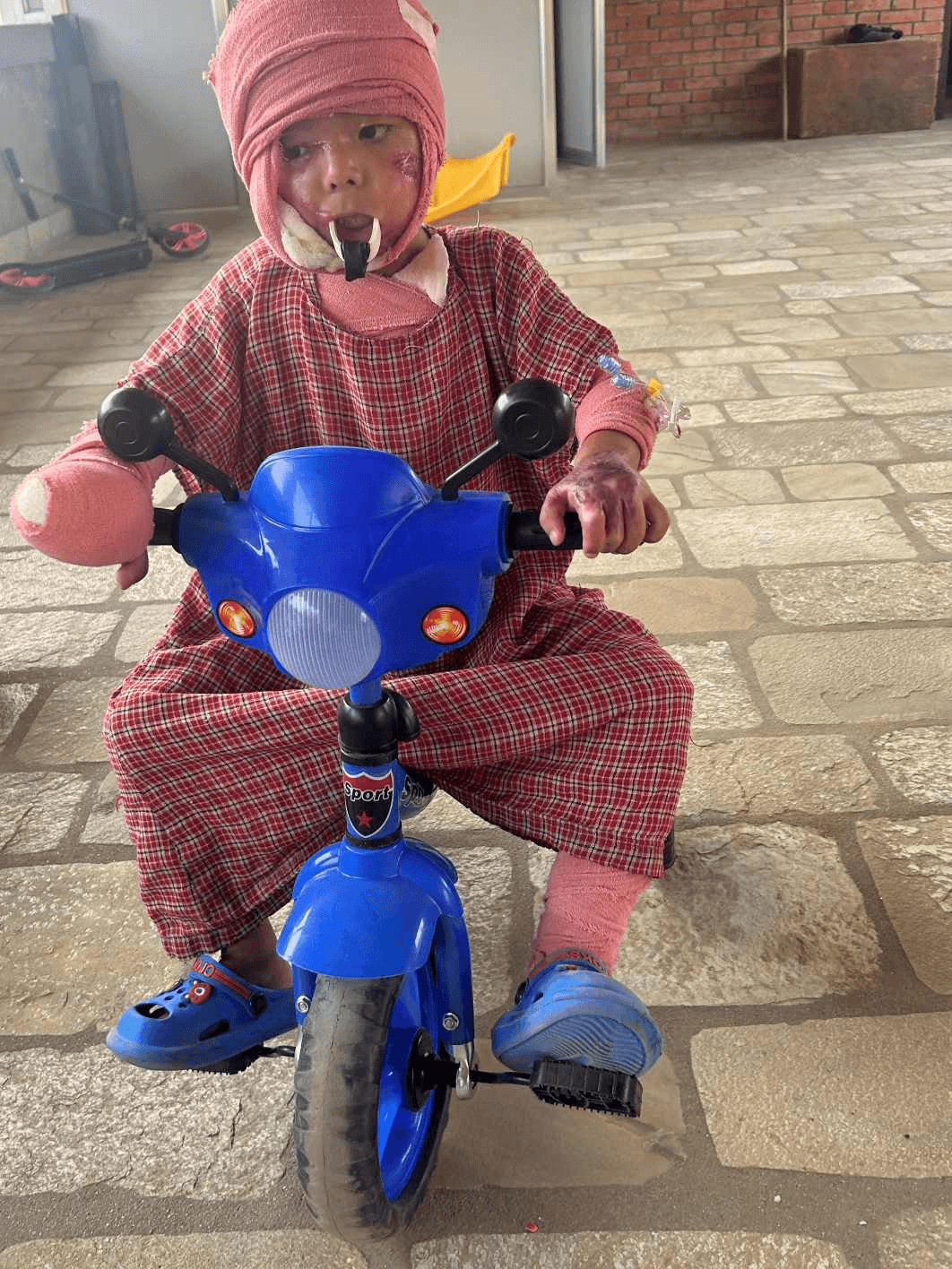 Pedaling Through Pain: How Courage and Care Helped Sakhar Heal